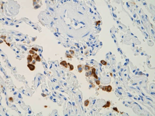 免疫組織化学の目的は何ですか?